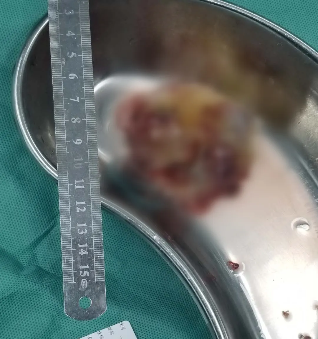 1592293396586066835.jpg 3.jpg