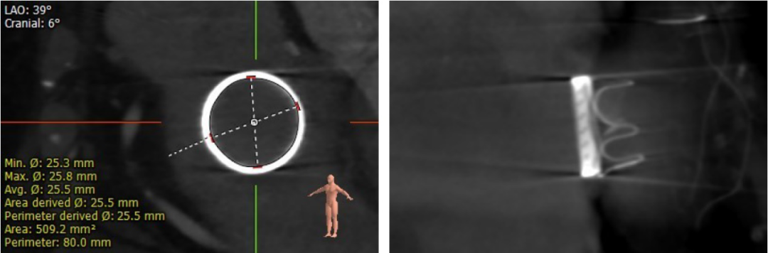 1622714324483049152.png 2.png