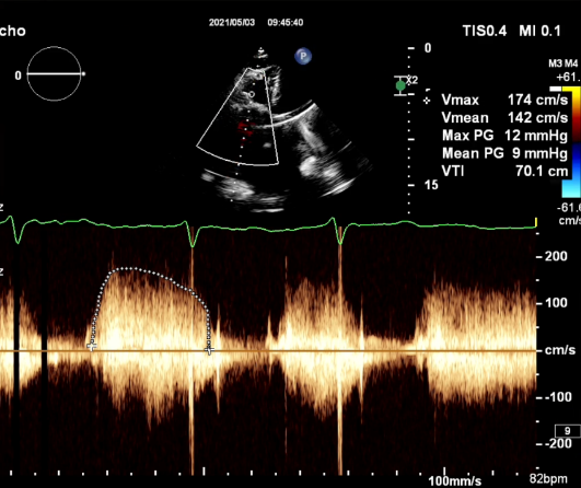 1622714658493034343.png 4.png